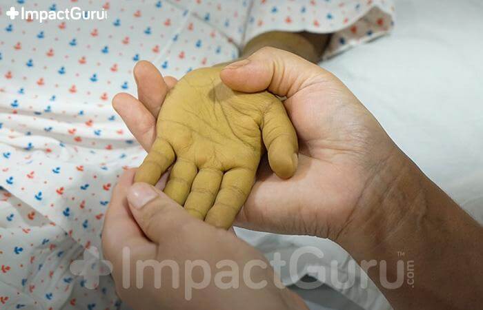ImpactgGuru