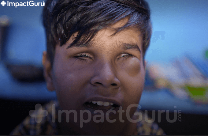 ImpactGuru