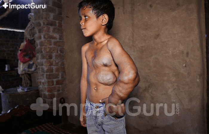 ImpactGuru