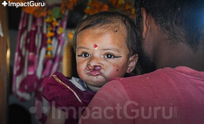 ImpactgGuru