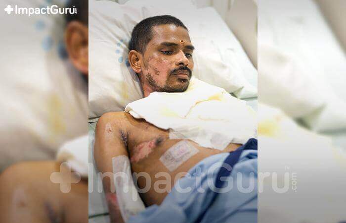 Story Image Impact Guru