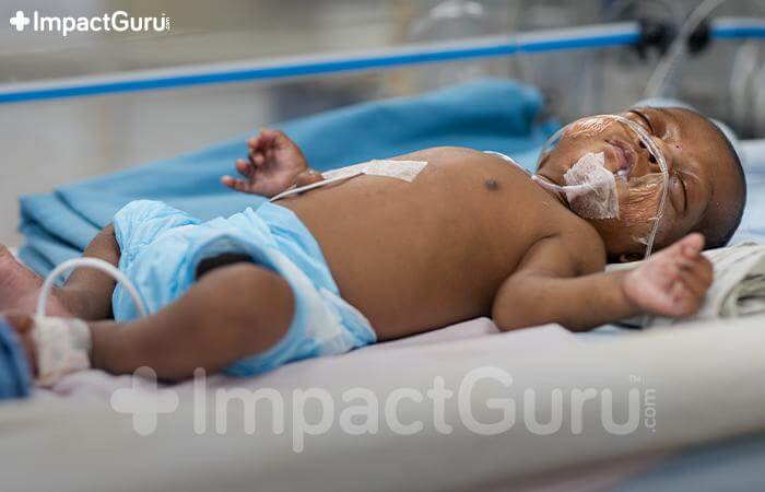 Story Image Impact Guru