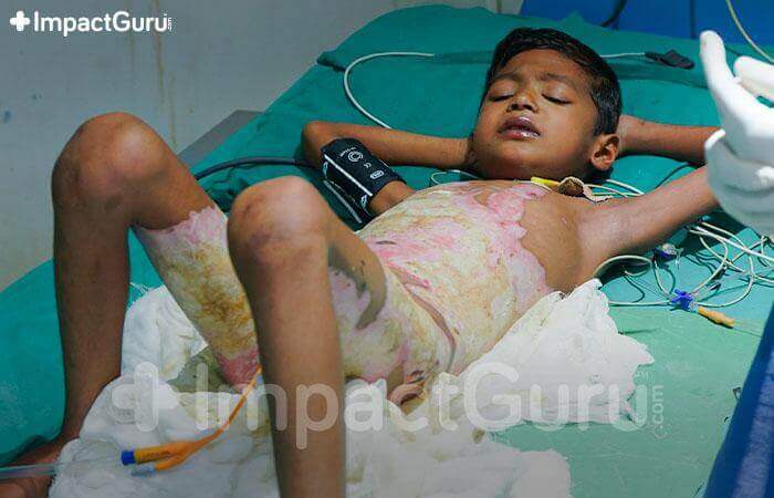 Story Image Impact Guru