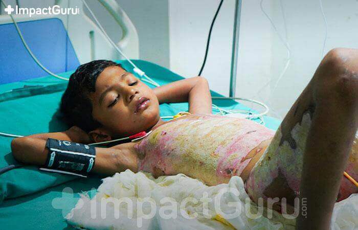 Story Image Impact Guru