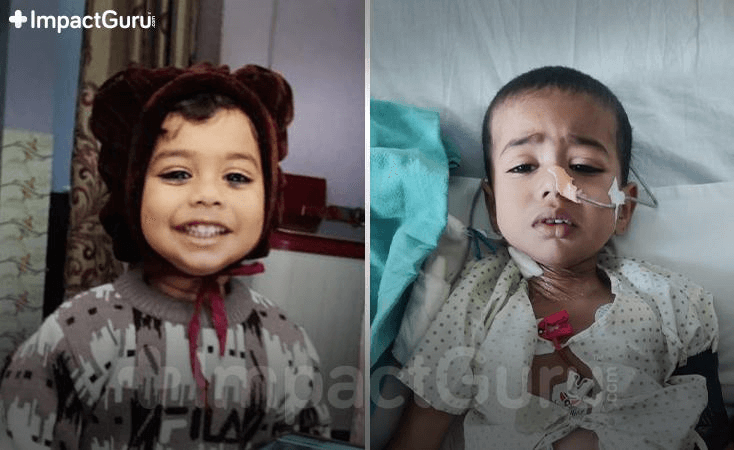 Story Image Impact Guru