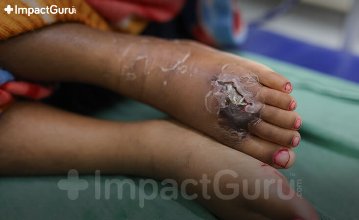 Story Image Impact Guru