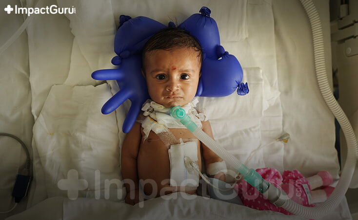 Story Image Impact Guru