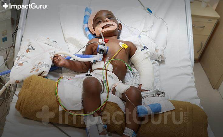 Story Image Impact Guru