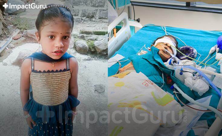 Story Image Impact Guru