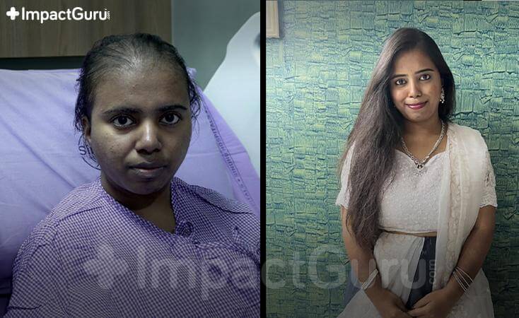 Story Image Impact Guru