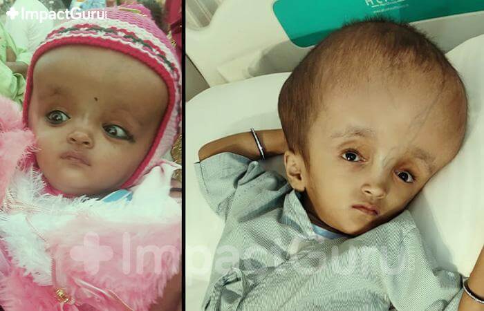 Story Image Impact Guru