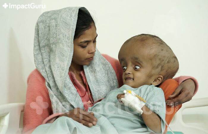 Story Image Impact Guru