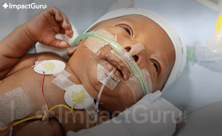 Story Image Impact Guru