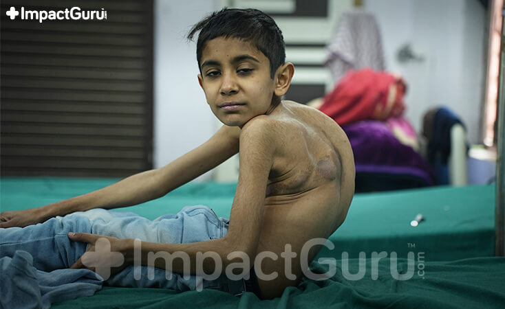 Story Image Impact Guru