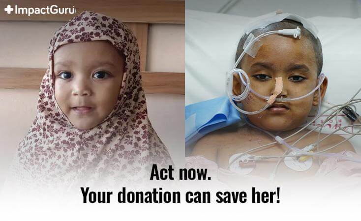 Story Image Impact Guru