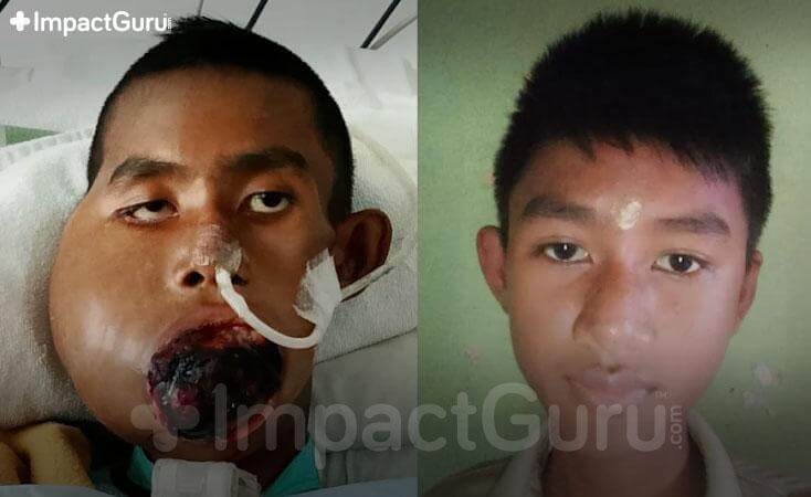 Story Image Impact Guru