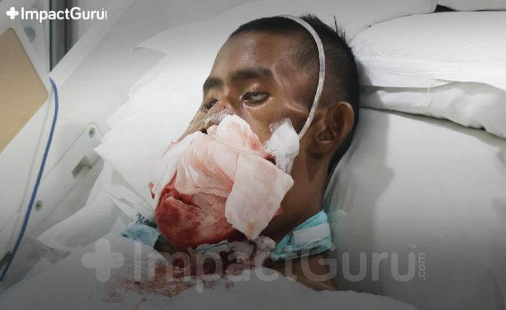 Story Image Impact Guru