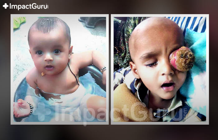 Story Image Impact Guru