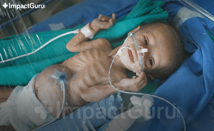 Story Image Impact Guru