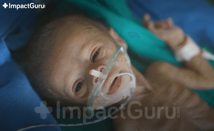 Story Image Impact Guru