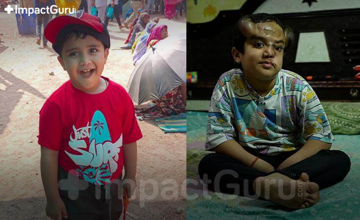 Story Image Impact Guru