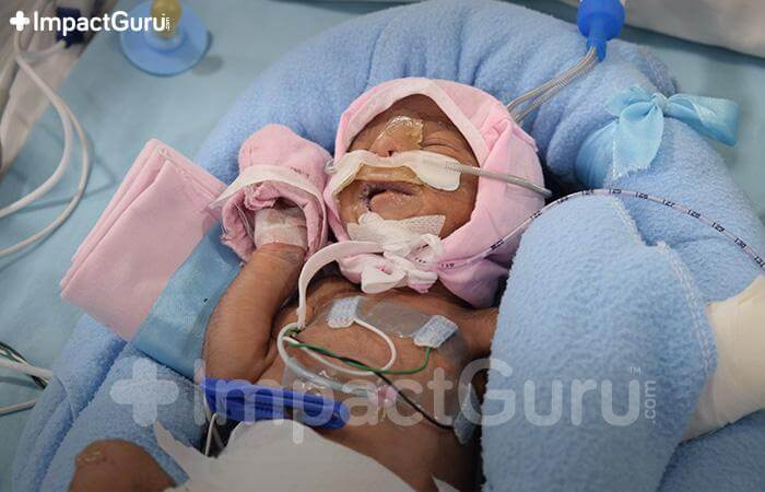 Story Image Impact Guru