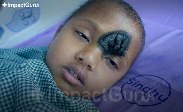 Story Image Impact Guru