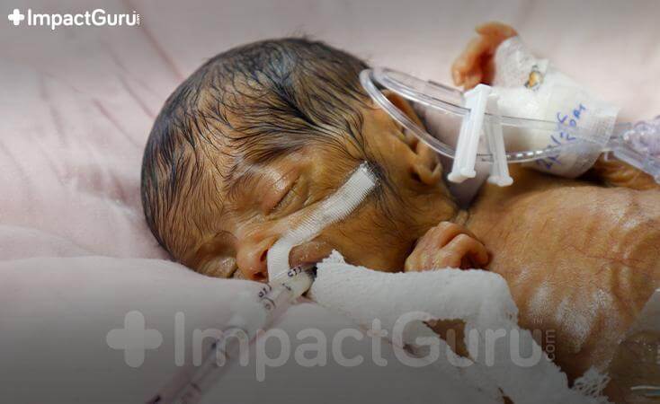 Story Image Impact Guru