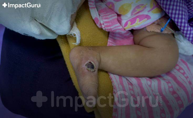 Story Image Impact Guru