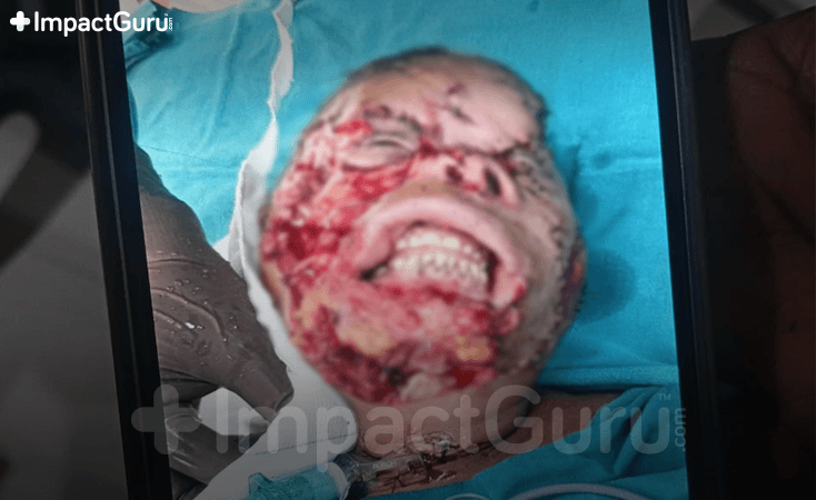 Story Image Impact Guru