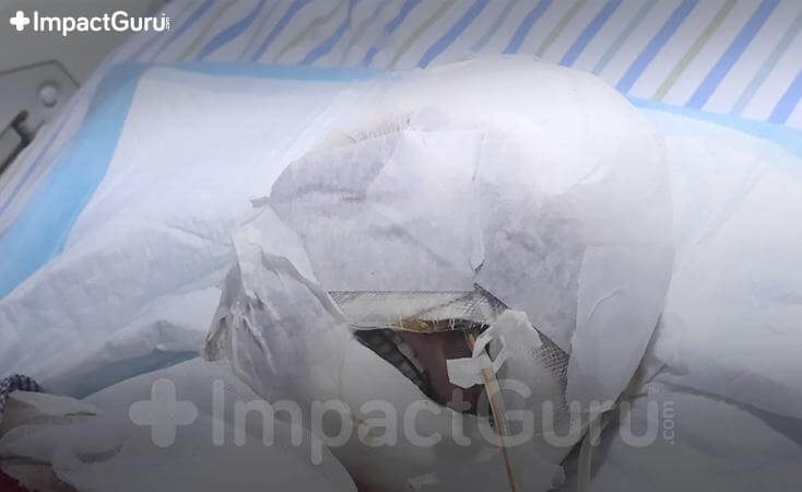 Story Image Impact Guru