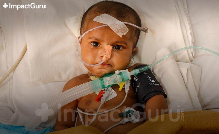 Story Image Impact Guru