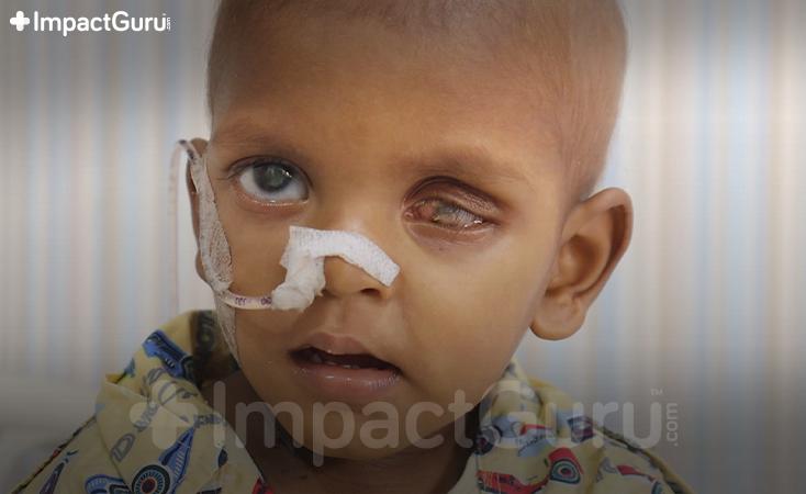 Story Image Impact Guru