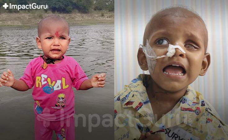 Story Image Impact Guru