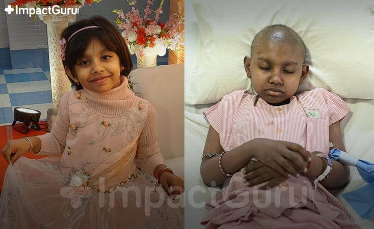 Story Image Impact Guru