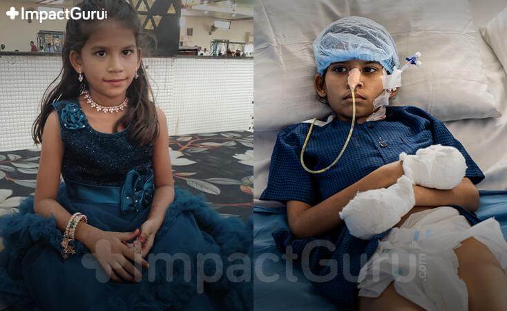 Story Image Impact Guru