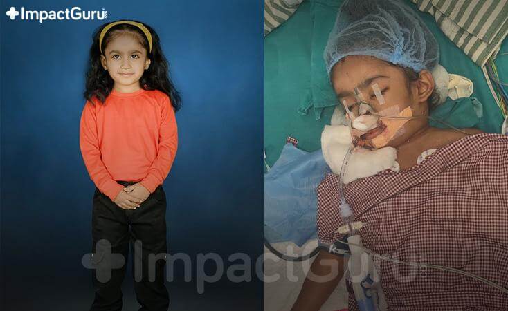 Story Image Impact Guru