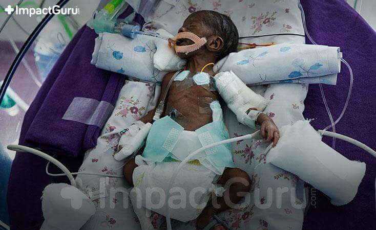 Story Image Impact Guru