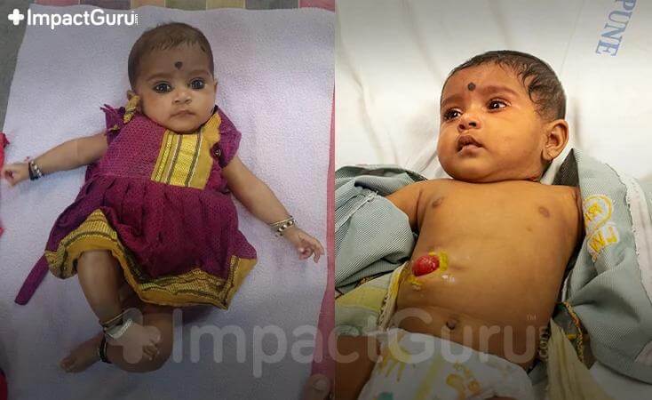 Story Image Impact Guru