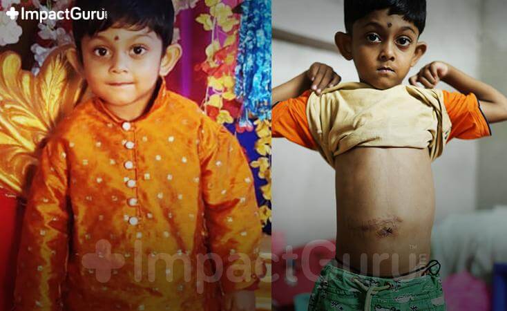 Story Image Impact Guru