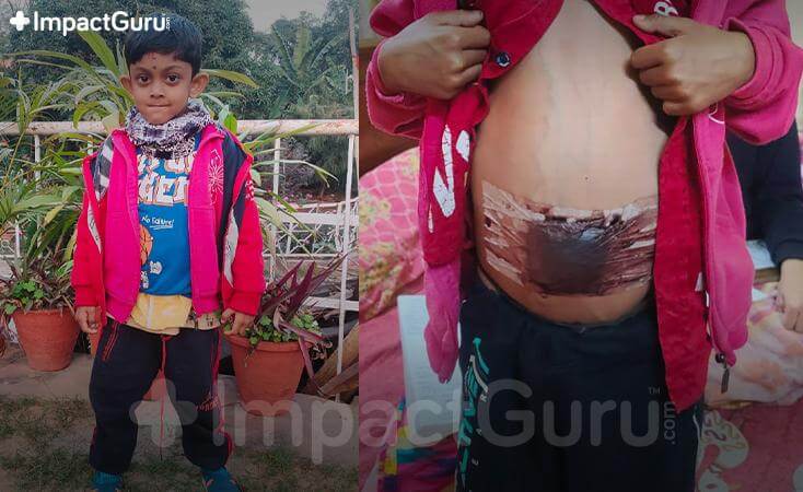 Story Image Impact Guru