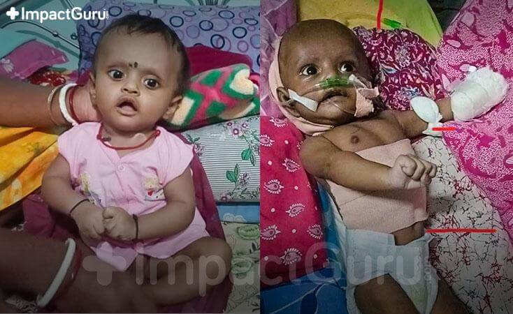 Story Image Impact Guru