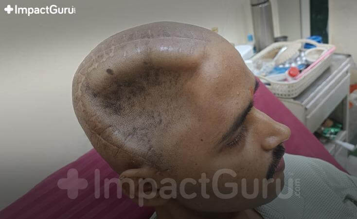 Story Image Impact Guru