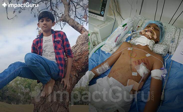 Story Image Impact Guru