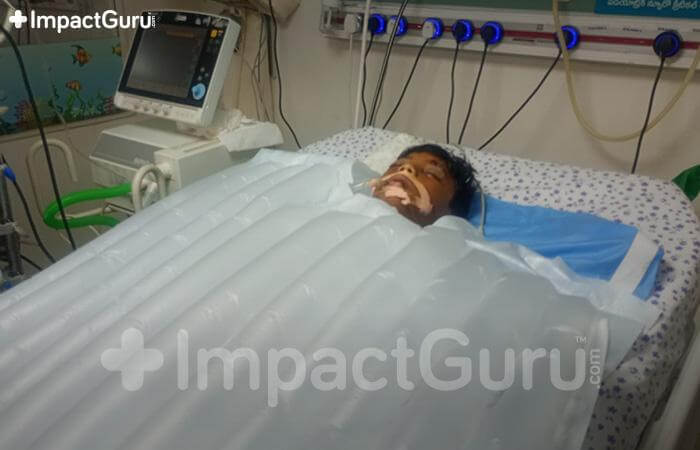 Story Image Impact Guru