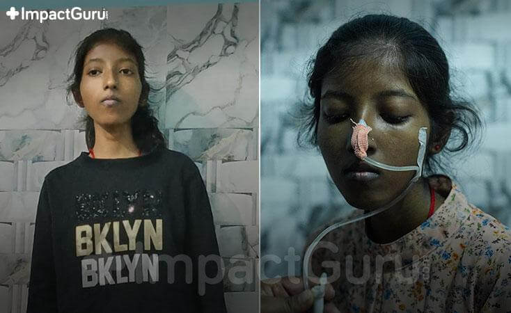 Story Image Impact Guru