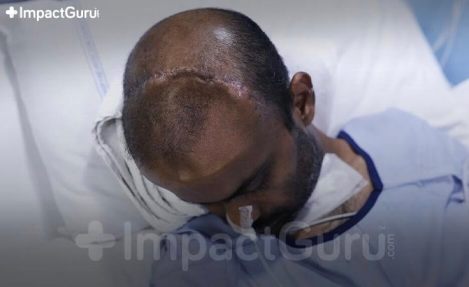Story Image Impact Guru