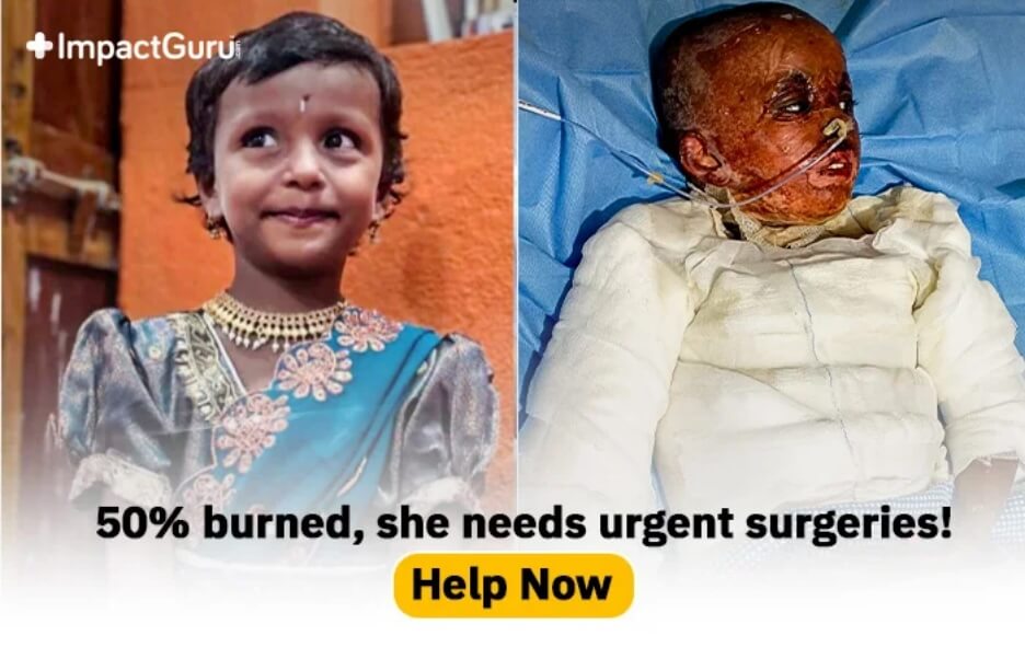 Story Image Impact Guru