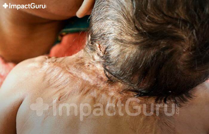 ImpactgGuru