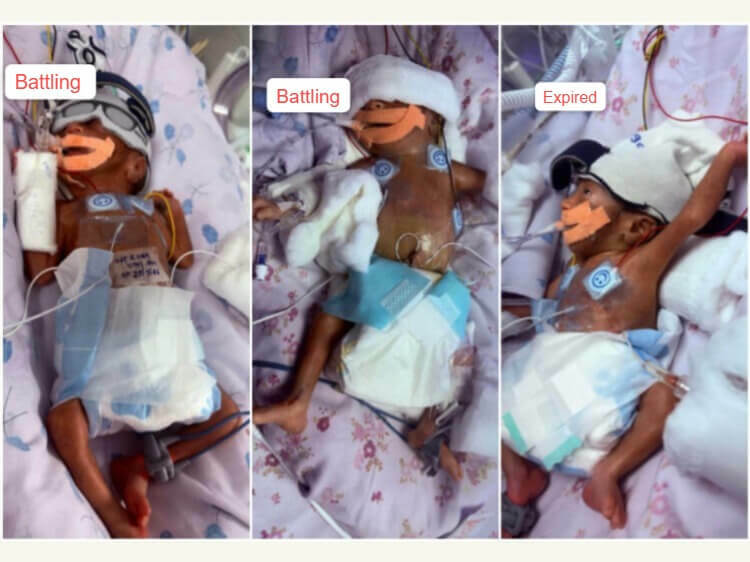 Triplets of Sandhya
